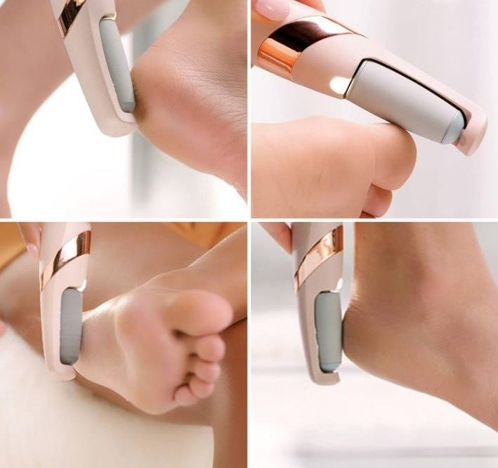 Rechargeable Electric Foot Filer – Callus & Cracked Heel Remover - Image 6